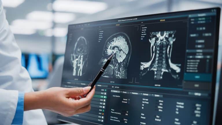 Image of Doctor looking at a brain scan